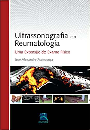 Ultrassonografia em Reumatologia: Uma Extensão do Exame Físico
